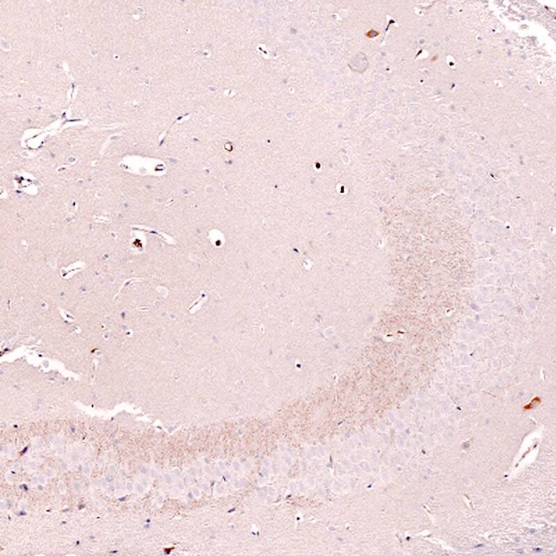 Nectin-3/PVRL3 Antibody (CL15366) - Azide and BSA Free Immunohistochemistry-Paraffin: Nectin-3/PVRL3 Antibody [NBP3-44181]