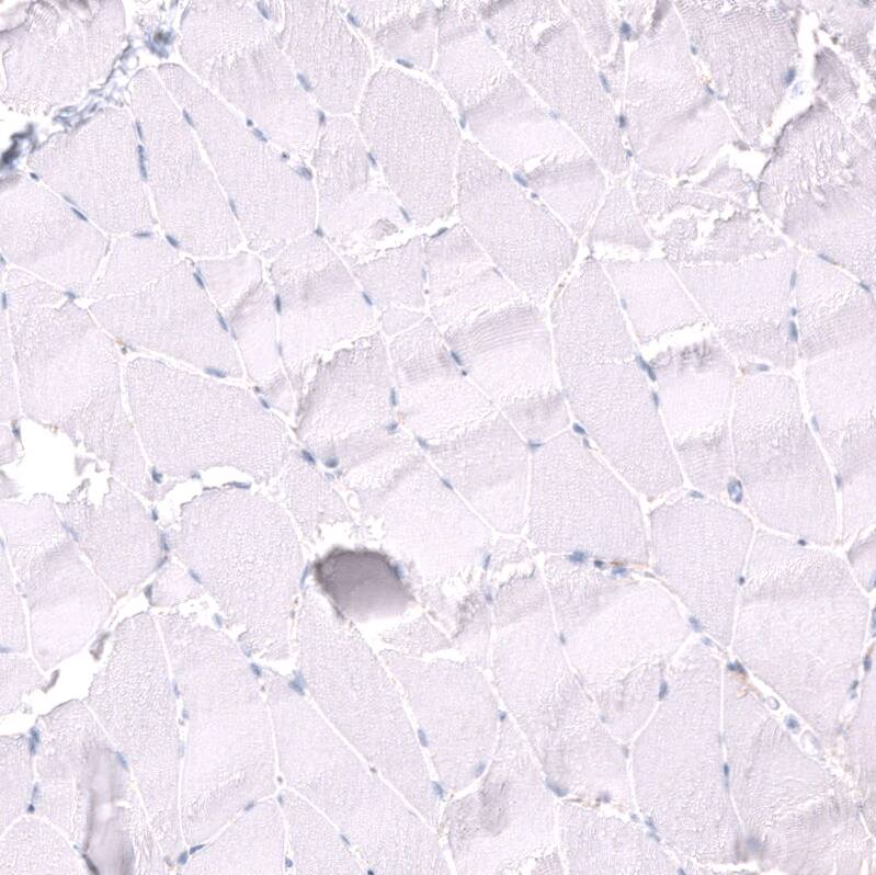 Nectin-3/PVRL3 Antibody (CL15366) - Azide and BSA Free Immunohistochemistry-Paraffin: Nectin-3/PVRL3 Antibody [NBP3-44181]