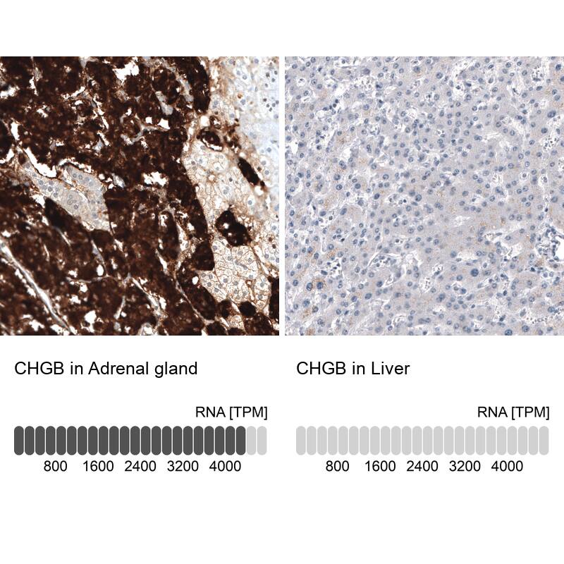 Chromogranin B Antibody (CL11404) - Azide and BSA Free Immunohistochemistry-Paraffin: Chromogranin B Antibody [NBP3-44183]