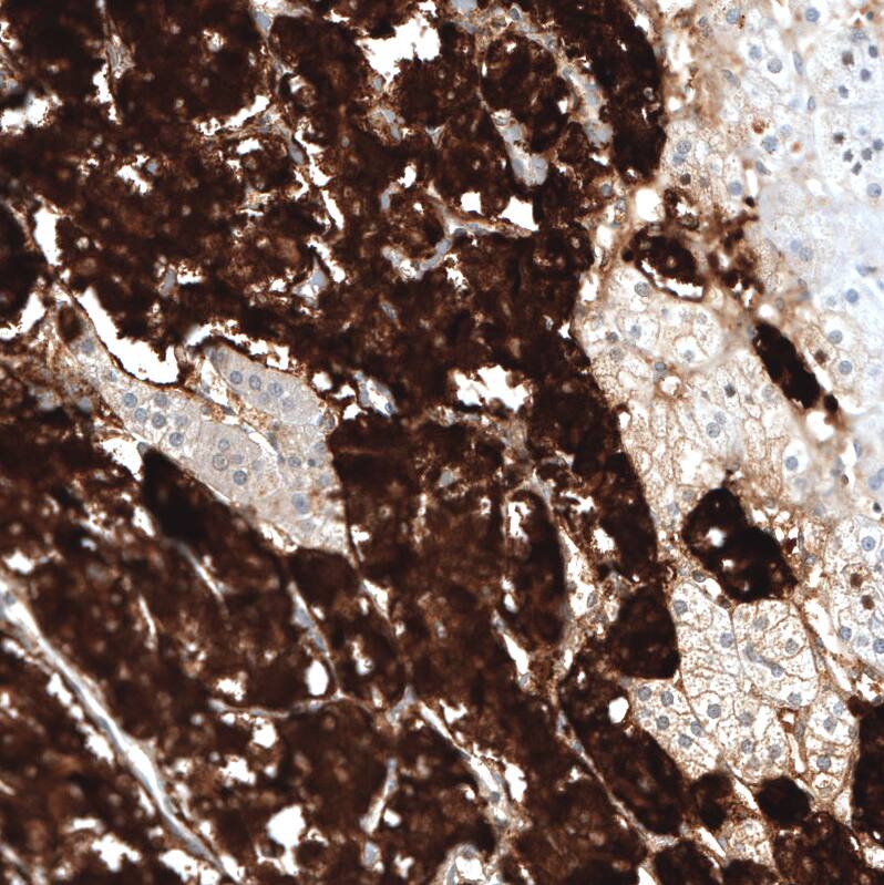 Chromogranin B Antibody (CL11404) - Azide and BSA Free Immunohistochemistry-Paraffin: Chromogranin B Antibody [NBP3-44183]