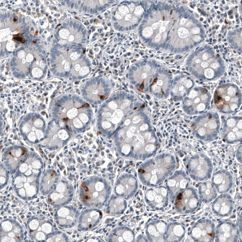 Chromogranin B Antibody (CL11404) - Azide and BSA Free Immunohistochemistry-Paraffin: Chromogranin B Antibody [NBP3-44183]