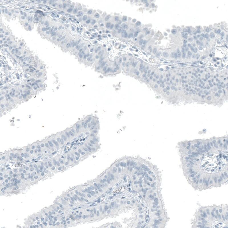 OTP Antibody (CL11225) - Azide and BSA Free Immunohistochemistry-Paraffin: OTP Antibody [NBP3-44185]