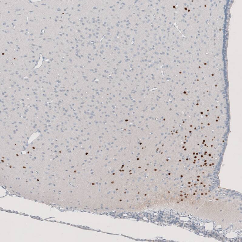 OTP Antibody (CL11225) - Azide and BSA Free Immunohistochemistry-Paraffin: OTP Antibody [NBP3-44185]