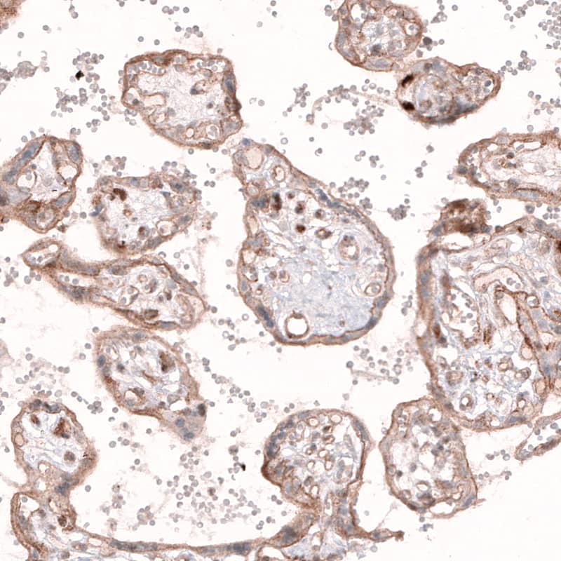 ROR2 Antibody (CL5950) - Azide and BSA Free Immunohistochemistry-Paraffin: ROR2 Antibody [NBP3-44186]