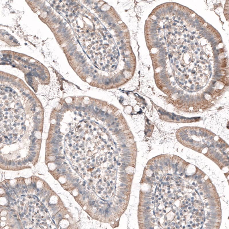 ROR2 Antibody (CL5950) - Azide and BSA Free Immunohistochemistry-Paraffin: ROR2 Antibody [NBP3-44186]