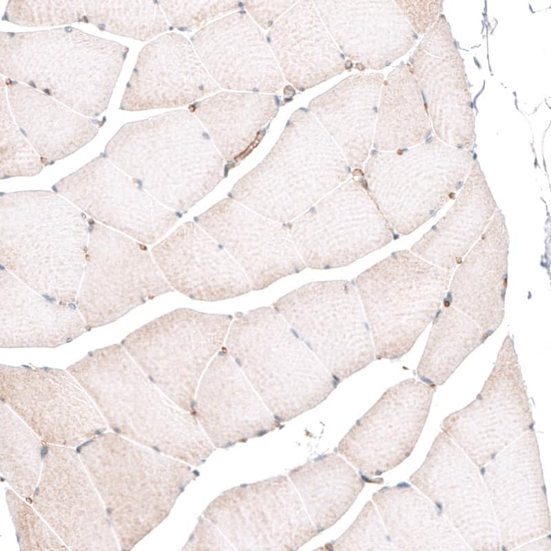 ROR2 Antibody (CL5950) - Azide and BSA Free Immunohistochemistry-Paraffin: ROR2 Antibody [NBP3-44186]