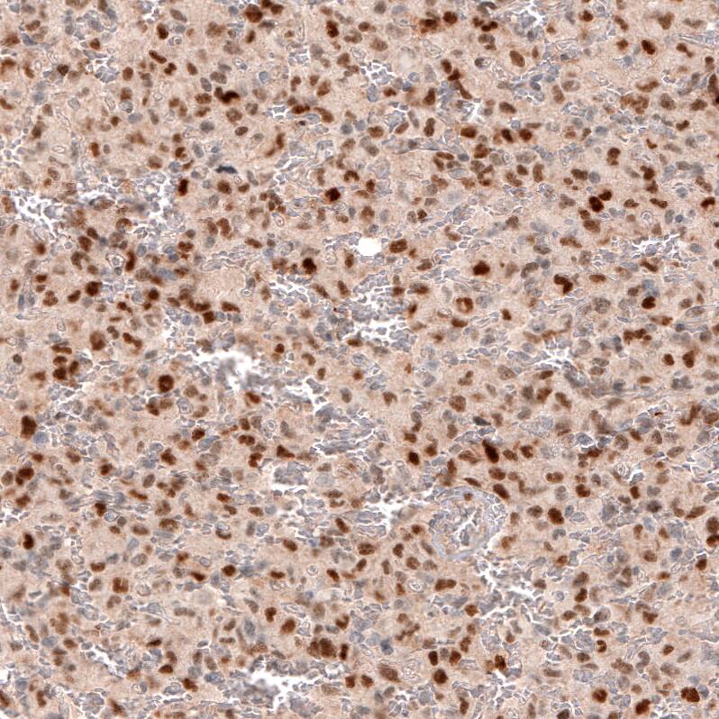 SOX4 Antibody (CL5634) - Azide and BSA Free Immunohistochemistry-Paraffin: SOX4 Antibody [NBP3-44187]