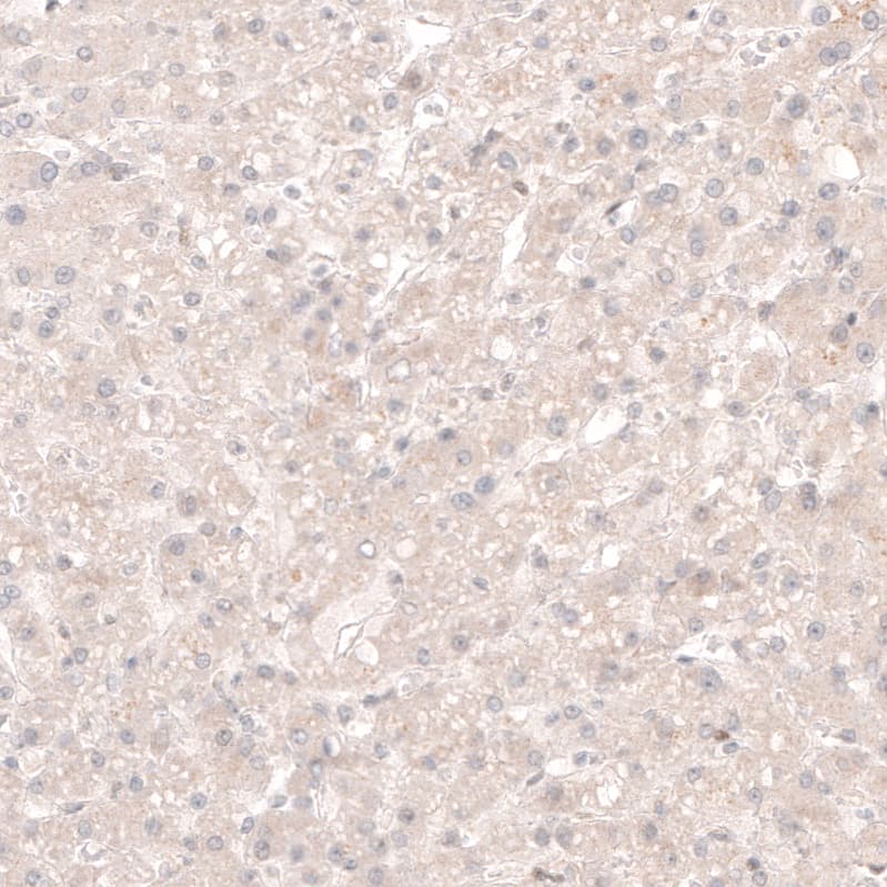 SOX4 Antibody (CL5634) - Azide and BSA Free Immunohistochemistry-Paraffin: SOX4 Antibody [NBP3-44187]