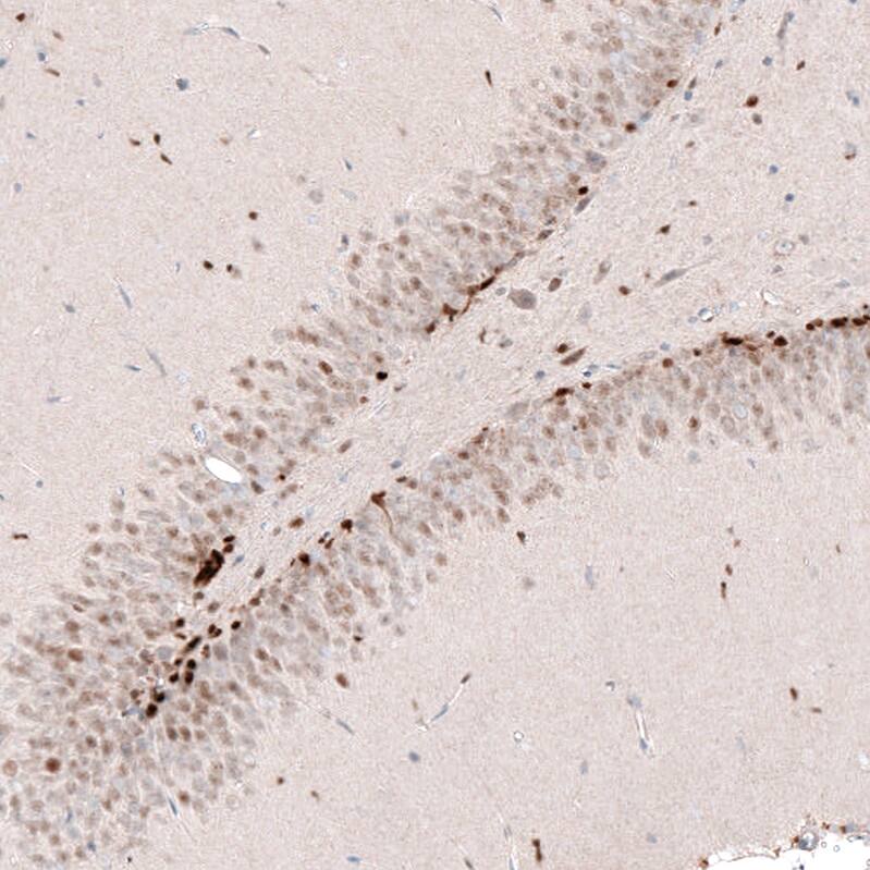SOX4 Antibody (CL5634) - Azide and BSA Free Immunohistochemistry-Paraffin: SOX4 Antibody [NBP3-44187]