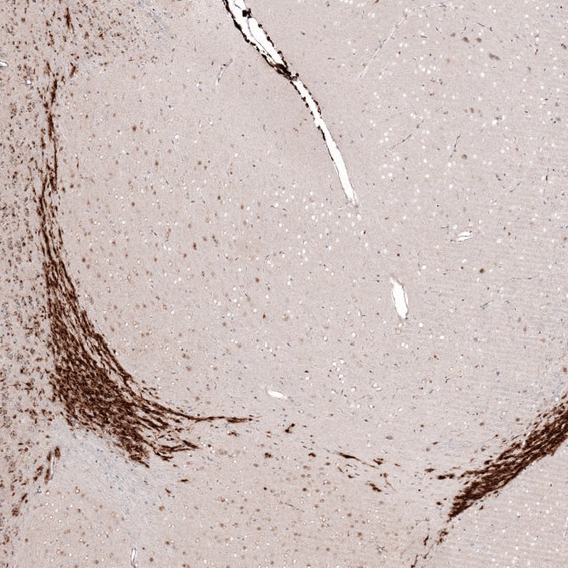 SOX4 Antibody (CL5634) - Azide and BSA Free Immunohistochemistry-Paraffin: SOX4 Antibody [NBP3-44187]