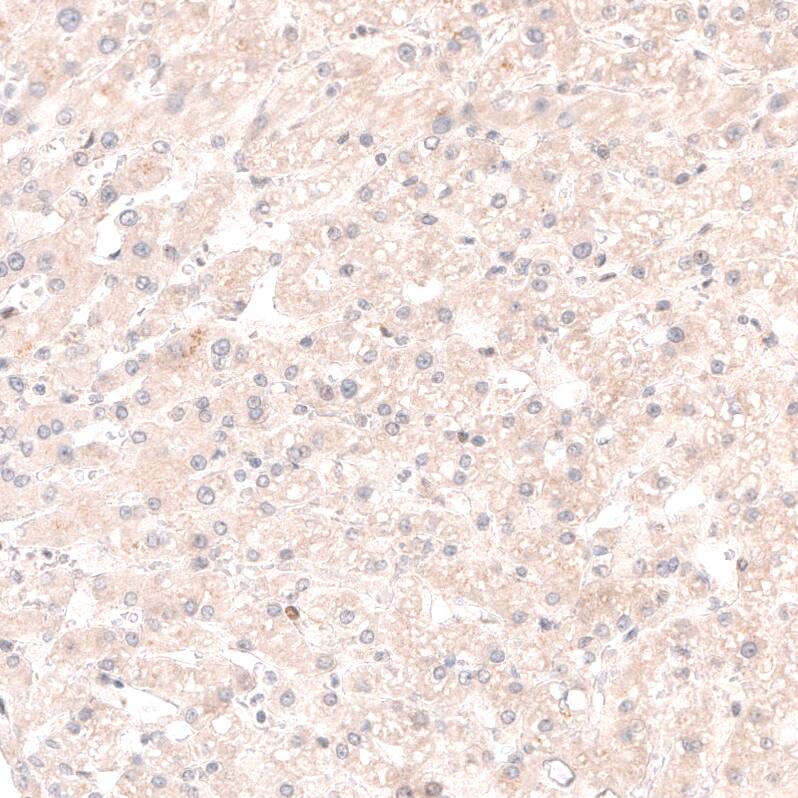 SOX4 Antibody (CL5665) - Azide and BSA Free Immunohistochemistry-Paraffin: SOX4 Antibody [NBP3-44188]