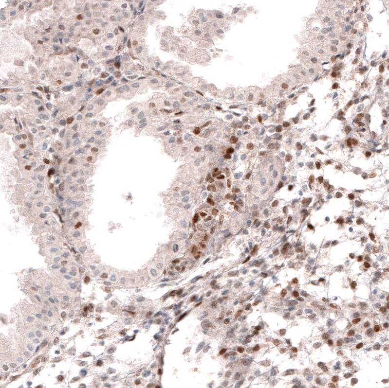 SOX4 Antibody (CL5665) - Azide and BSA Free Immunohistochemistry-Paraffin: SOX4 Antibody [NBP3-44188]