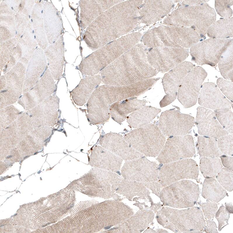 myosin X Antibody (CL9032) - Azide and BSA Free Immunohistochemistry-Paraffin: myosin X Antibody [NBP3-44191]