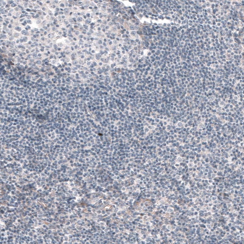 G6PC Antibody (CL5817) - Azide and BSA Free Immunohistochemistry-Paraffin: G6PC Antibody [NBP3-44192]