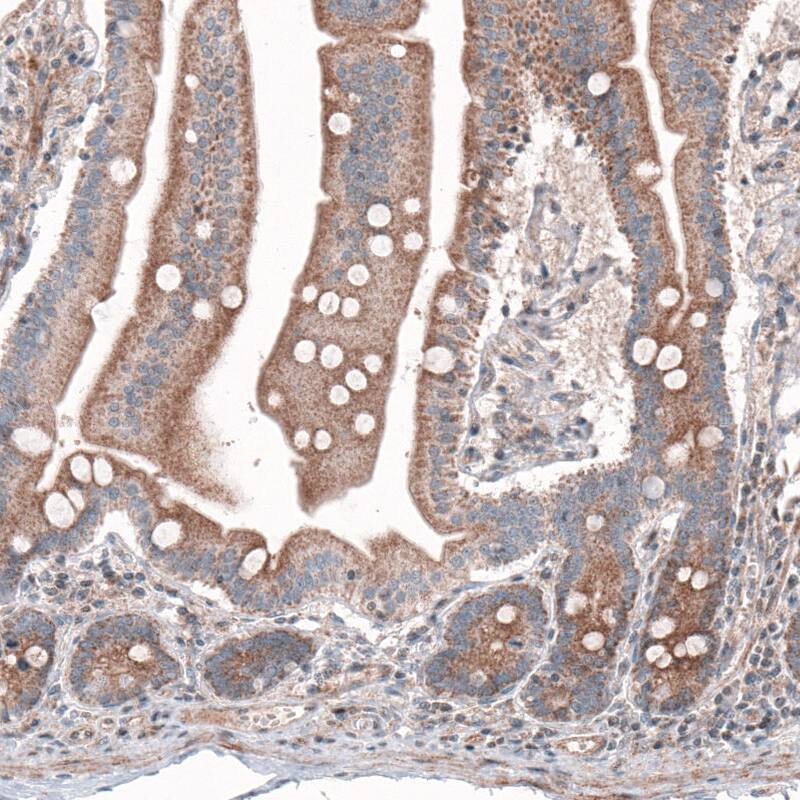 G6PC Antibody (CL5818) - Azide and BSA Free Immunohistochemistry-Paraffin: G6PC Antibody [NBP3-44193]