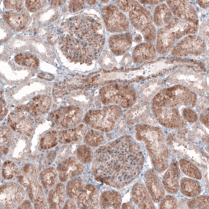 G6PC Antibody (CL5818) - Azide and BSA Free Immunohistochemistry-Paraffin: G6PC Antibody [NBP3-44193]