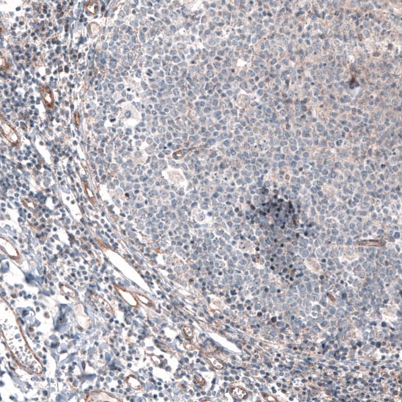 G6PC Antibody (CL5818) - Azide and BSA Free Immunohistochemistry-Paraffin: G6PC Antibody [NBP3-44193]