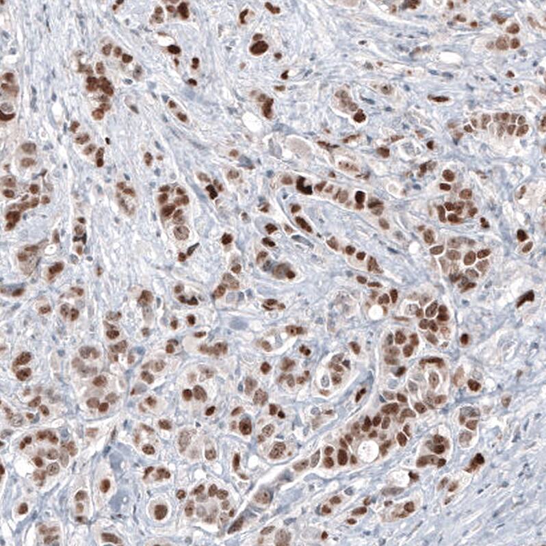 GATA-3 Antibody (CL8660) - Azide and BSA Free Immunohistochemistry-Paraffin: GATA-3 Antibody [NBP3-44195]