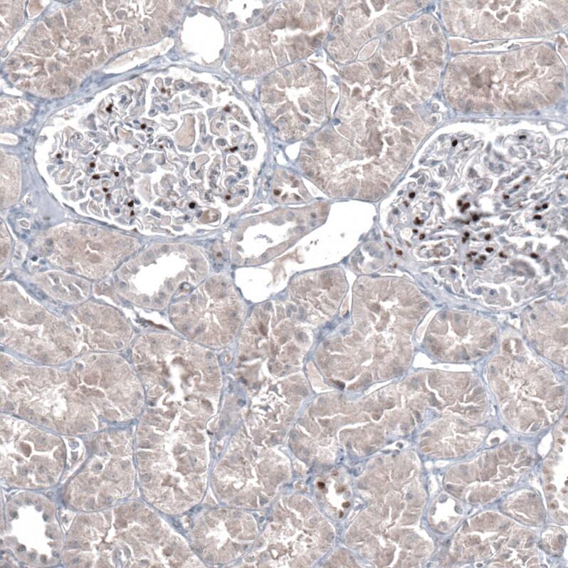 GATA-3 Antibody (CL8660) - Azide and BSA Free Immunohistochemistry-Paraffin: GATA-3 Antibody [NBP3-44195]