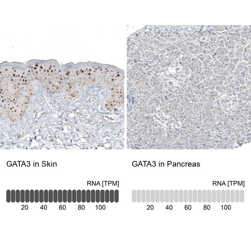 GATA-3 Antibody (CL8660) - Azide and BSA Free Immunohistochemistry-Paraffin: GATA-3 Antibody [NBP3-44195]