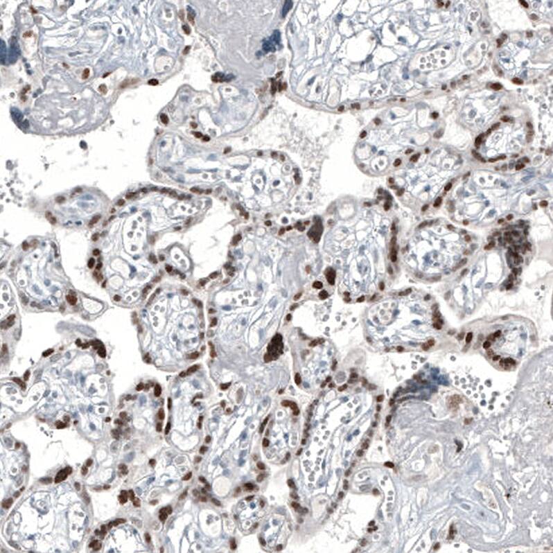 GATA-3 Antibody (CL8660) - Azide and BSA Free Immunohistochemistry-Paraffin: GATA-3 Antibody [NBP3-44195]