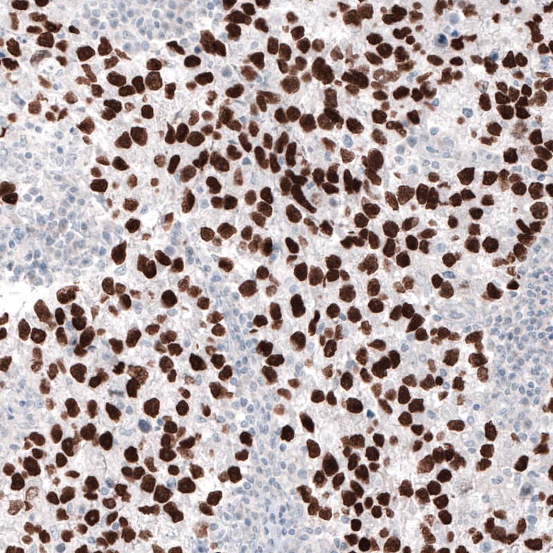 Nanog Antibody (CL5803) - Azide and BSA Free Immunohistochemistry-Paraffin: Nanog Antibody [NBP3-44196]