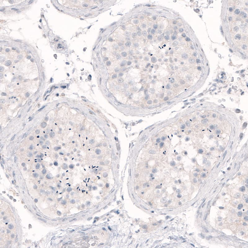 Nanog Antibody (CL5810) - Azide and BSA Free Immunohistochemistry-Paraffin: Nanog Antibody [NBP3-44197]