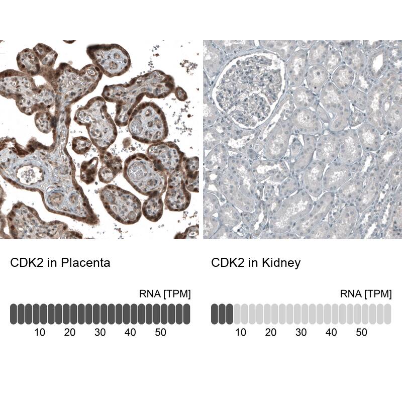 CDK2 Antibody (CL7990) - Azide and BSA Free Immunohistochemistry-Paraffin: CDK2 Antibody [NBP3-44198]
