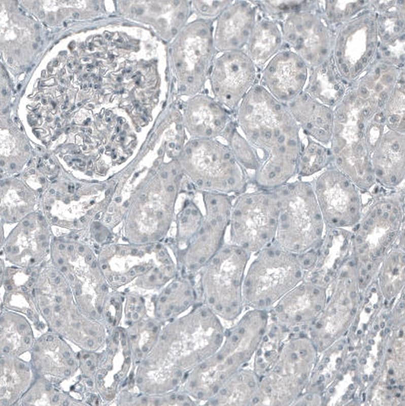 CDK2 Antibody (CL7990) - Azide and BSA Free Immunohistochemistry-Paraffin: CDK2 Antibody [NBP3-44198]