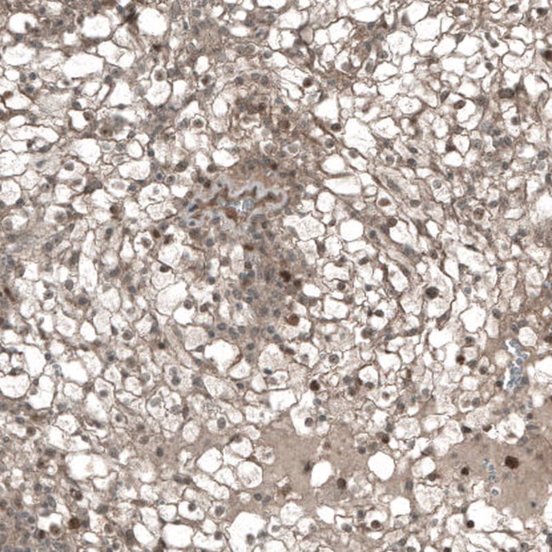 CDK2 Antibody (CL7990) - Azide and BSA Free Immunohistochemistry-Paraffin: CDK2 Antibody [NBP3-44198]