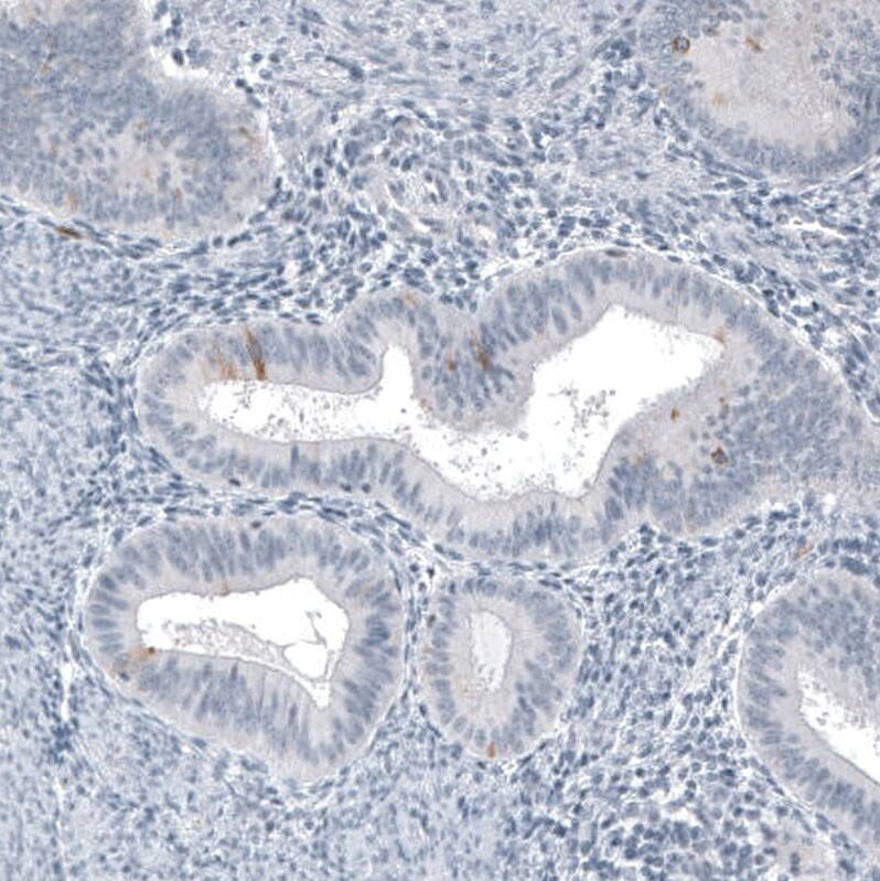 Astrin Antibody (CL10078) - Azide and BSA Free Immunohistochemistry-Paraffin: Astrin Antibody [NBP3-44199]