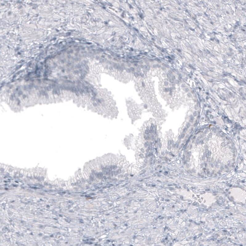 Astrin Antibody (CL10078) - Azide and BSA Free Immunohistochemistry-Paraffin: Astrin Antibody [NBP3-44199]
