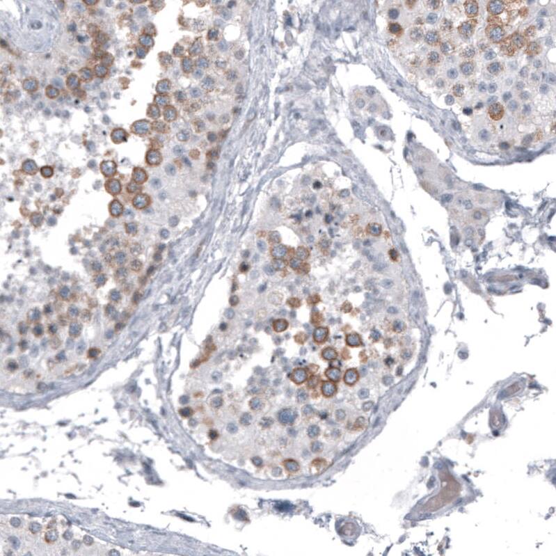 Astrin Antibody (CL10078) - Azide and BSA Free Immunohistochemistry-Paraffin: Astrin Antibody [NBP3-44199]