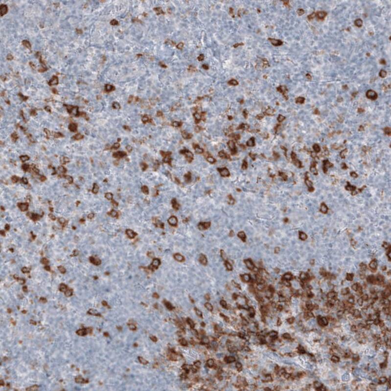 Astrin Antibody (CL10078) - Azide and BSA Free Immunohistochemistry-Paraffin: Astrin Antibody [NBP3-44199]