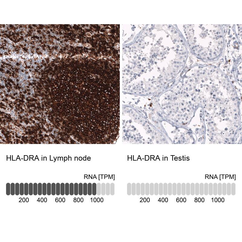 HLA DRA Antibody (CL10964) - Azide and BSA Free Immunohistochemistry-Paraffin: HLA DRA Antibody [NBP3-44200]