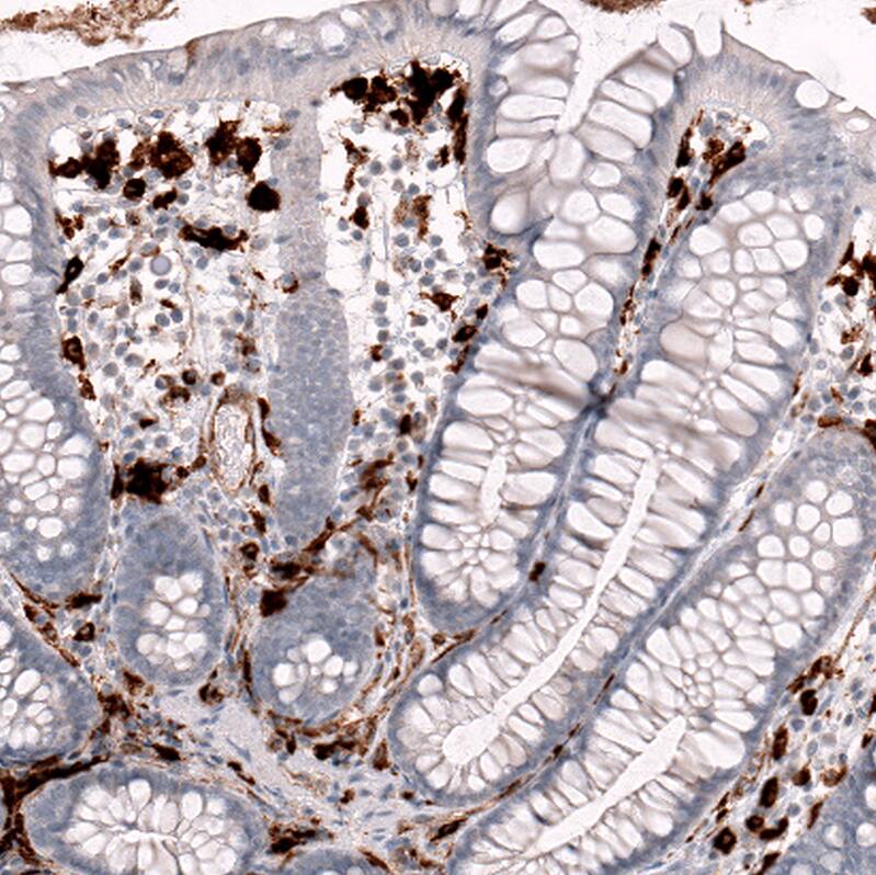HLA DRA Antibody (CL10964) - Azide and BSA Free Immunohistochemistry-Paraffin: HLA DRA Antibody [NBP3-44200]