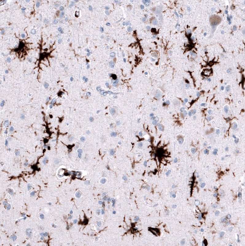 HLA DRA Antibody (CL10964) - Azide and BSA Free Immunohistochemistry-Paraffin: HLA DRA Antibody [NBP3-44200]