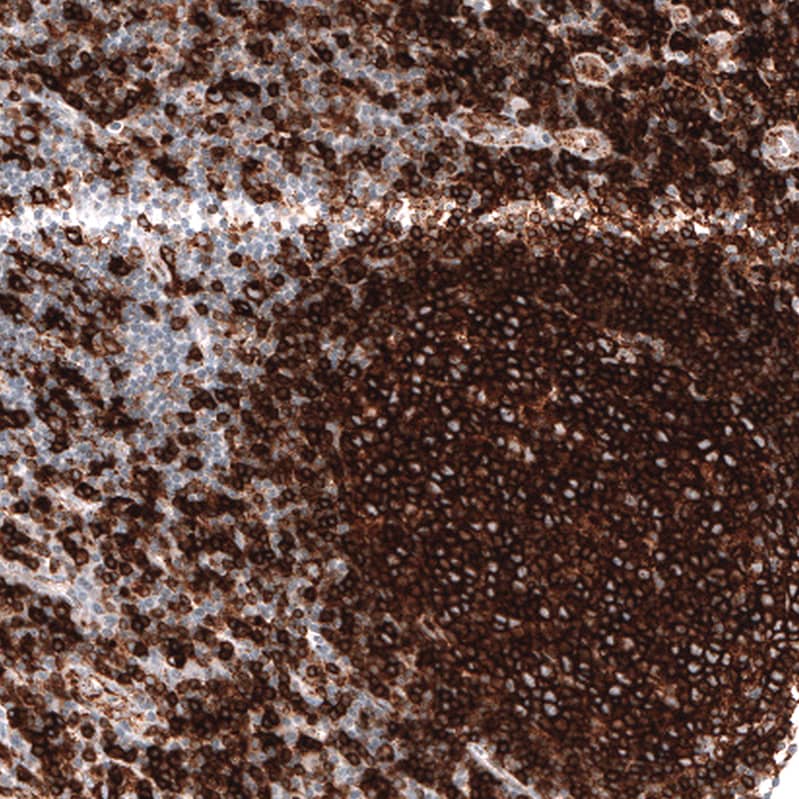 HLA DRA Antibody (CL10964) - Azide and BSA Free Immunohistochemistry-Paraffin: HLA DRA Antibody [NBP3-44200]
