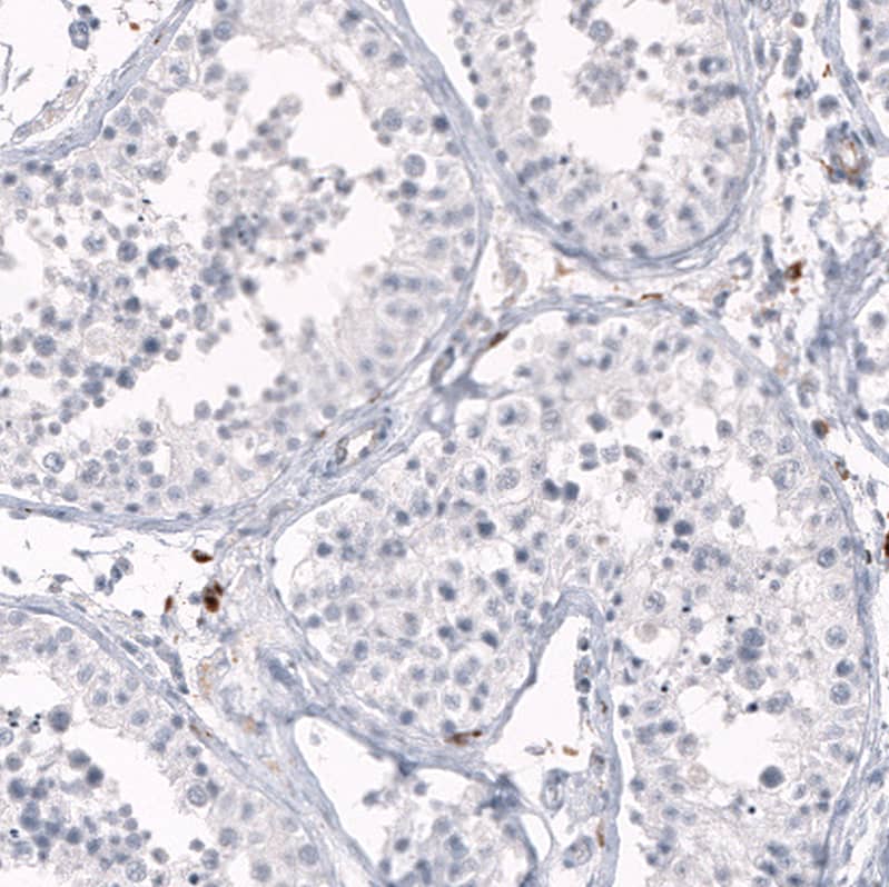 HLA DRA Antibody (CL10964) - Azide and BSA Free Immunohistochemistry-Paraffin: HLA DRA Antibody [NBP3-44200]