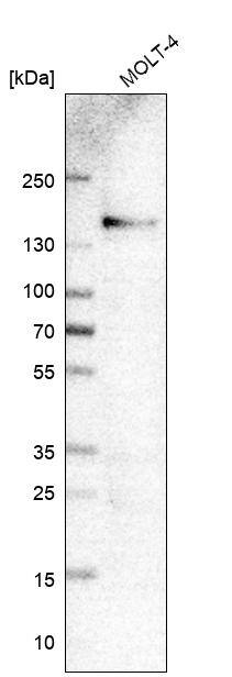 Integrin alpha 4/CD49d Antibody (CL11294) - Azide and BSA Free Western Blot: Integrin alpha 4/CD49d Antibody [NBP3-44201]