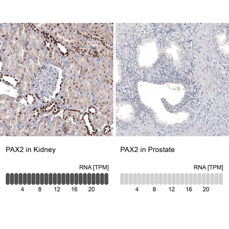 Pax2 Antibody (CL9469) - Azide and BSA Free Immunohistochemistry-Paraffin: Pax2 Antibody [NBP3-44202]