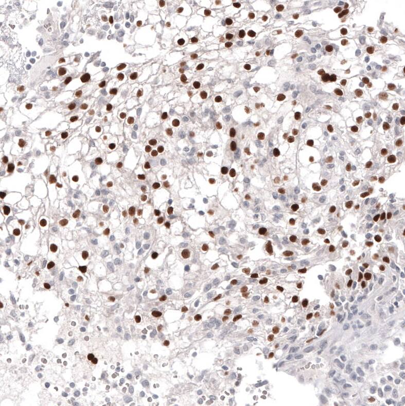 Pax2 Antibody (CL9469) - Azide and BSA Free Immunohistochemistry-Paraffin: Pax2 Antibody [NBP3-44202]