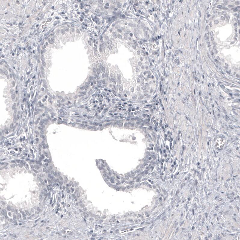 Pax2 Antibody (CL9469) - Azide and BSA Free Immunohistochemistry-Paraffin: Pax2 Antibody [NBP3-44202]