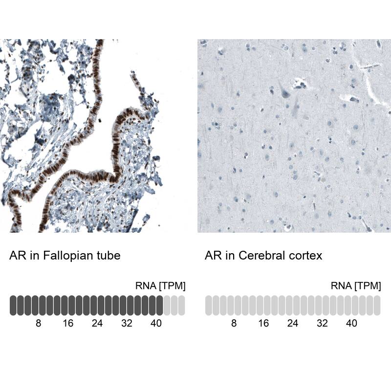 Androgen R/NR3C4 Antibody (CL9255) - Azide and BSA Free Immunohistochemistry-Paraffin: Androgen R/NR3C4 Antibody [NBP3-44204]