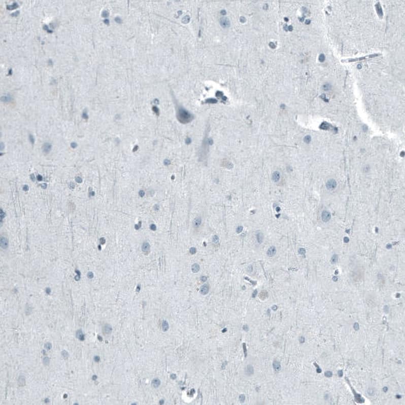 Androgen R/NR3C4 Antibody (CL9255) - Azide and BSA Free Immunohistochemistry-Paraffin: Androgen R/NR3C4 Antibody [NBP3-44204]