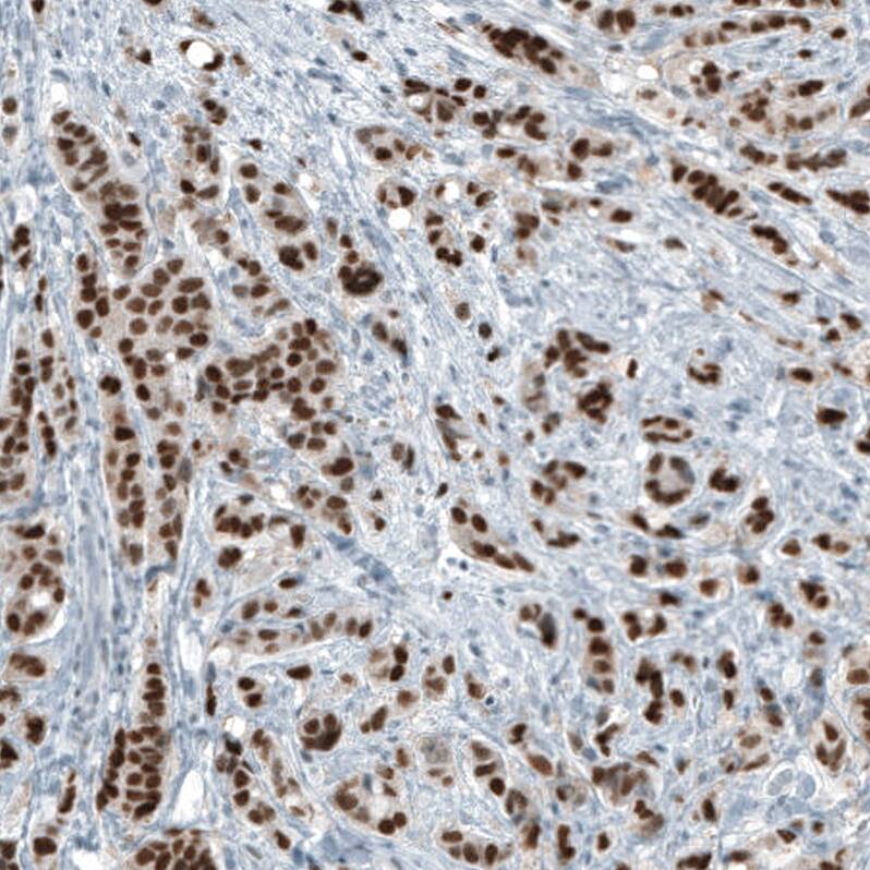 Androgen R/NR3C4 Antibody (CL9255) - Azide and BSA Free Immunohistochemistry-Paraffin: Androgen R/NR3C4 Antibody [NBP3-44204]