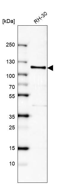 Androgen R/NR3C4 Antibody (CL9255) - Azide and BSA Free Western Blot: Androgen R/NR3C4 Antibody [NBP3-44204]
