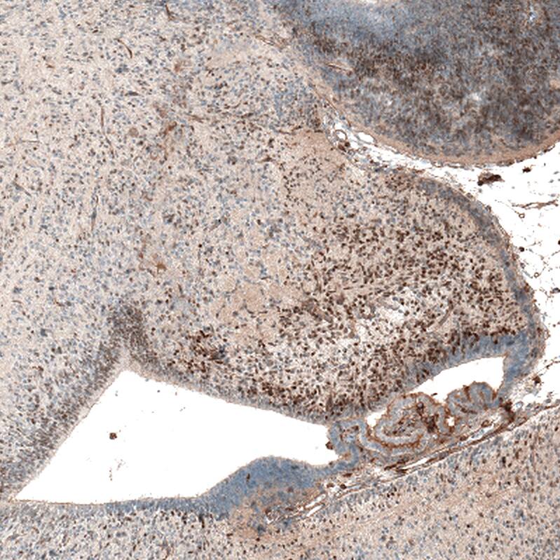 AUTS2 Antibody (CL7084) - Azide and BSA Free Immunohistochemistry-Paraffin: AUTS2 Antibody [NBP3-44206]