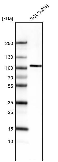 AUTS2 Antibody (CL7084) - Azide and BSA Free Western Blot: AUTS2 Antibody [NBP3-44206]