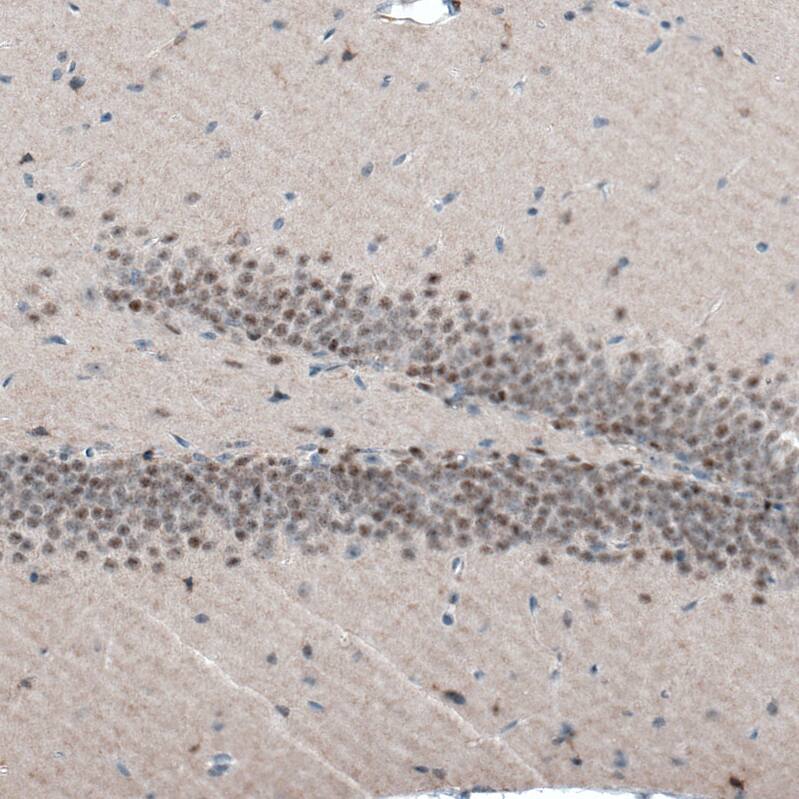 AUTS2 Antibody (CL7084) - Azide and BSA Free Immunohistochemistry-Paraffin: AUTS2 Antibody [NBP3-44206]